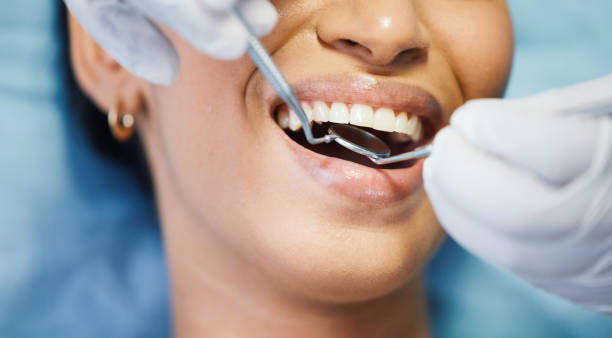Best Broken or Chipped Tooth Repair in Wayzata, MN